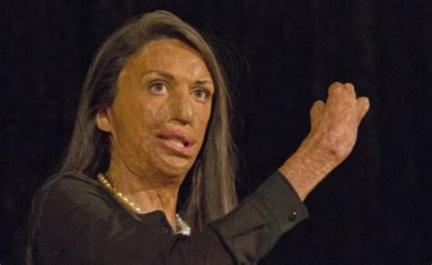 Turia Pitt S Journey From The Brink To Centre Stage The West Australian