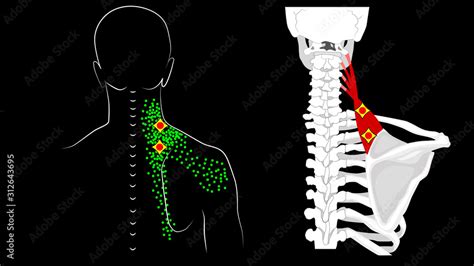 Levator Scapulae Muscle Trigger Points And Muscle Structure Pain In