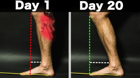 The Only Thing You Need To Fix Tight Calves