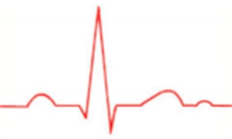 Miyokardit hastalarında, qrs süresinin uzamasının kardiyak ölüm ve kalp yetmezliği gelişme riski açısından. Erkrankungen vom Herz (Innere Medizin)