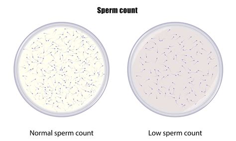 Sperm Counts Worldwide Have Plunged In Under Years Israeli Led