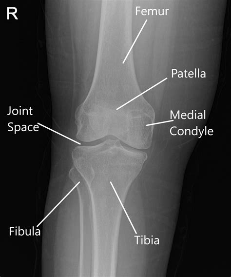 Knee Anatomy Medial View
