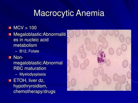Ppt Approach To The Patient With Anemia Powerpoint Presentation Free