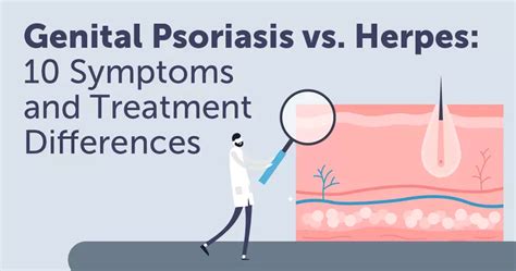 Genital Psoriasis Vs Herpes 10 Symptom And Treatment Differences