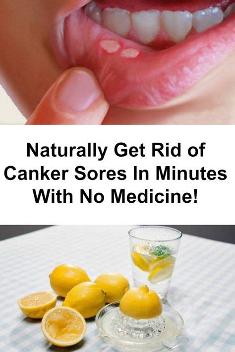 9 Best Mouth Images Remedies Home Remedies Canker Sore Remedy