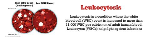 Leukocytosis Causes Symptoms Diagnosis Treatment