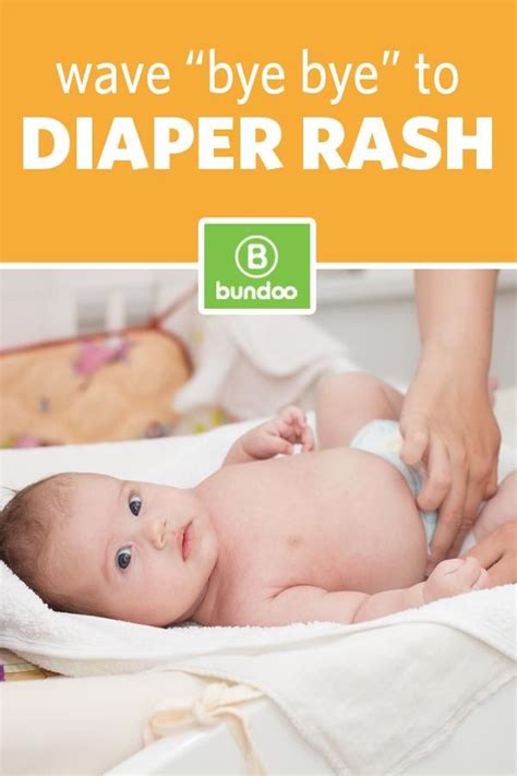 Tricks For Treating Diaper Rash Treating Diaper Rash Diaper Rash