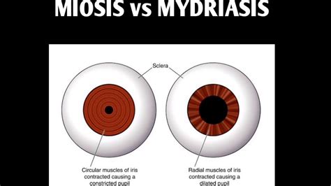 Miosis And Mydriasis Youtube