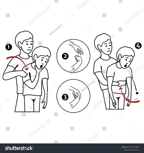 Heimlichs Maneuver First Aid Procedure Choking Stock Vector Royalty Free 2212349693 Shutterstock