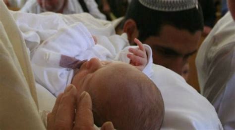 Israel Doctors Blast Blood Sucking Circumcision Rite The Forward
