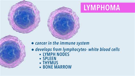 Lymphoma Classifications Cancerconnect