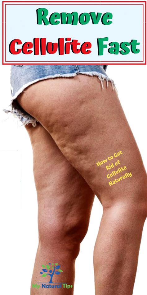 Pin On The Best Cellulite Removal Cream