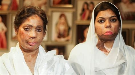 This Woman Is Fighting For Acid Attack Victims In Pakistan