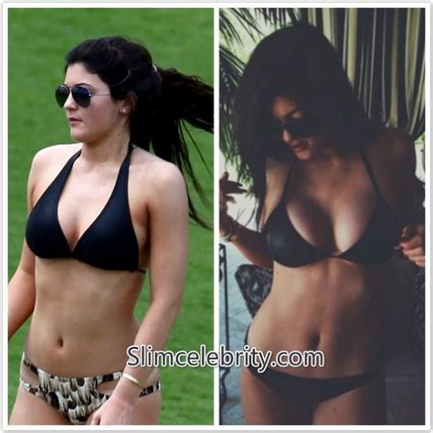 17 Best Images About Celebrity Breast Implants On