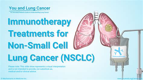 slide show immunotherapy treatments for non small cell lung cancer nsclc