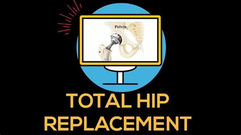 Total Hip Replacement Youtube