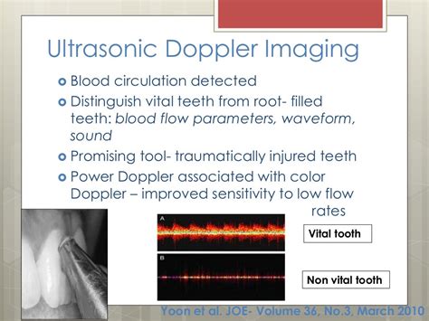 Endodontic Diagnosis