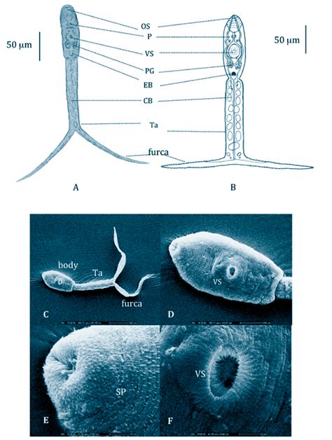 Images Of Apatemon Gracilis A Light Micrograph B Drawing Of