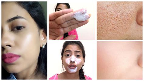 How To Shrink Large Pores Easily And Reduce Oily Skin Instantly1 Simple