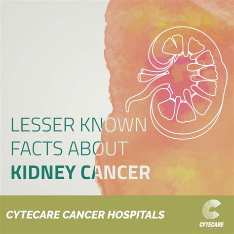 Kidney Cancer 11 Facts You Should Know About Kidney Cancer