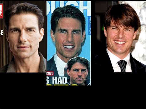 Tom Cruise Plastic Surgery Before And After In 2014 He Starred Edge Of
