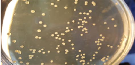 Smooth Honey Colored Colonies Of B Abortus Strain 99 Grown In