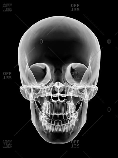 Human Skull X Ray Artwork Stock Photo Offset