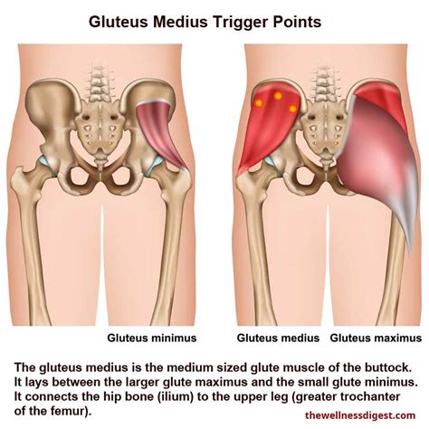 We did not find results for: Gluteus Medius Muscle: Outside of Hip, Buttock, Low Back ...