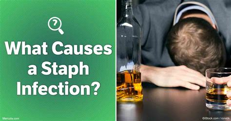 What Causes A Staph Infection