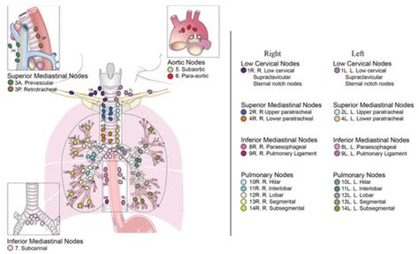 Diagnostics Free Full Text Role Of Ebus Tbna In Non Neoplastic