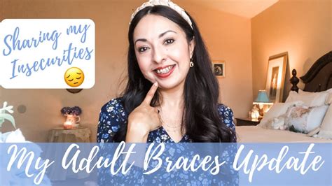 My Adult Braces Update Two Months With Braces Sharing My Insecurities Youtube