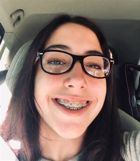 Braces And Aligners Traditional Custom And Invisalign Masterpiece Smiles