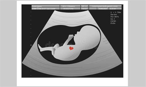 Ultrasound Of Unborn Baby In Mother`s Womb Medical Concept Vector