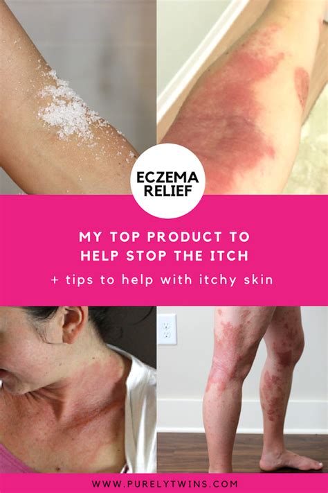 How To Help Stop The Itch My Secret Eczema Tips