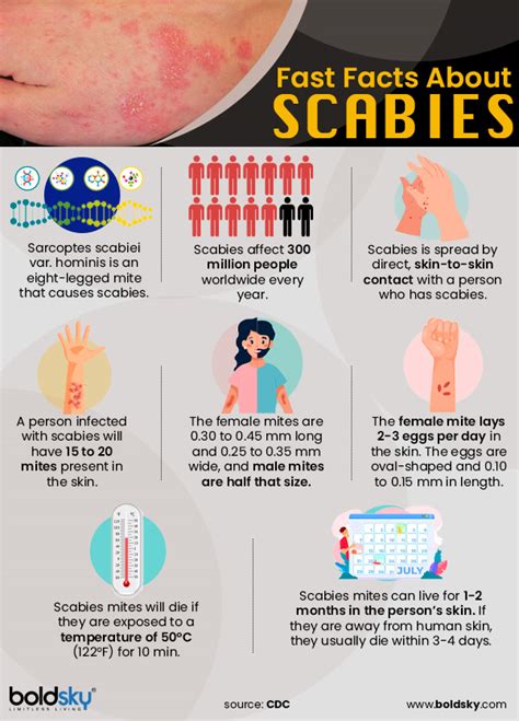 scabies causes transmission symptoms diagnosis treatment and prevention