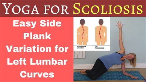 Exercise For Scoliosis S Curve Online Degrees