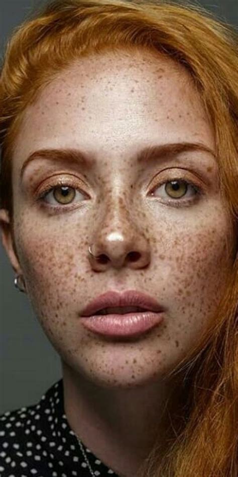 A Woman With Freckles On Her Face