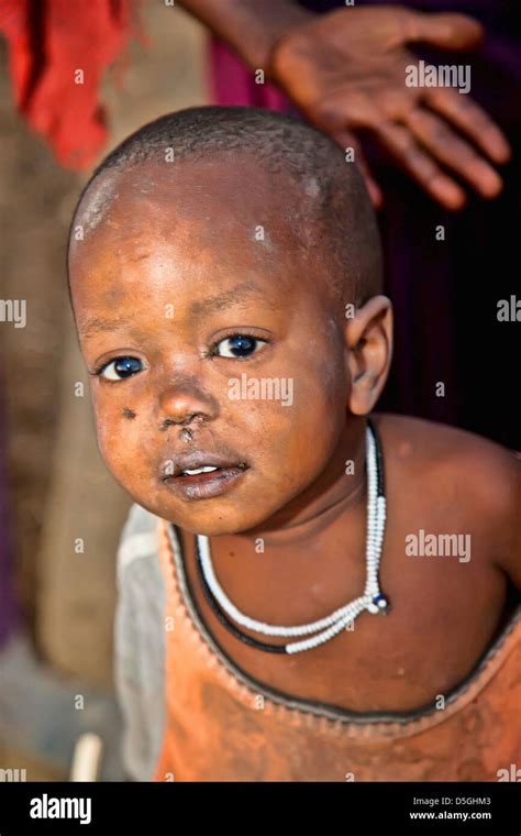 One Year Old Maasai Child In African Orphan Children Near Moashi