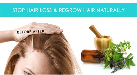 How To Stop Hair Loss And Regrow Hair Naturally Regrow Hair Naturally