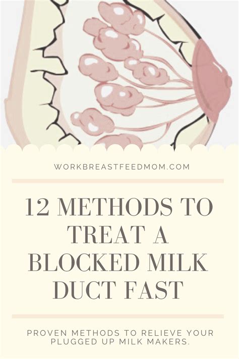 Clogged Milk Duct Plugged Milk Duct Blocked Milk Duct Clogged Milk Duct Remedies Pumping