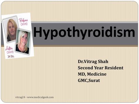 Perioperative Management Of Hypothyroid Patients Undergoing