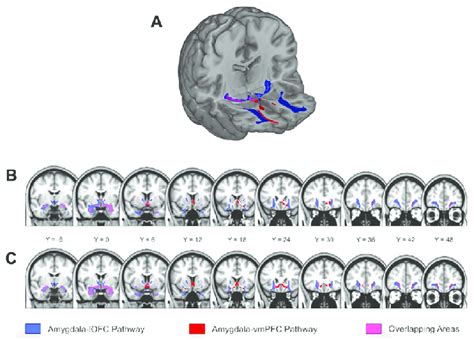 Amygdala Lateral Orbitofrontal Cortex Lofc And Download