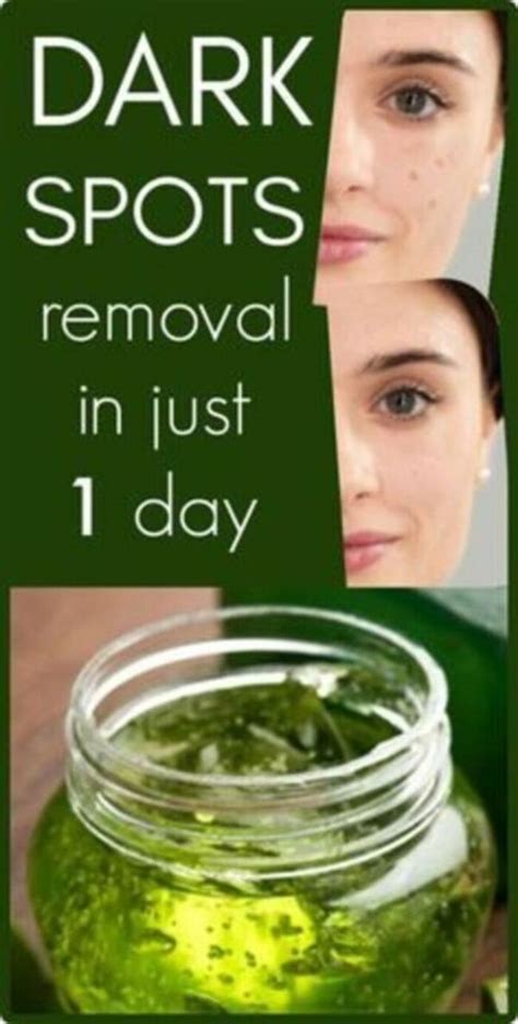 i got shocked with the results of this magical remedy it removed dark spot in 1 day dark
