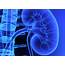 Kidney Biopsy Analysis Reveals High Risk For Disease In Patients With 