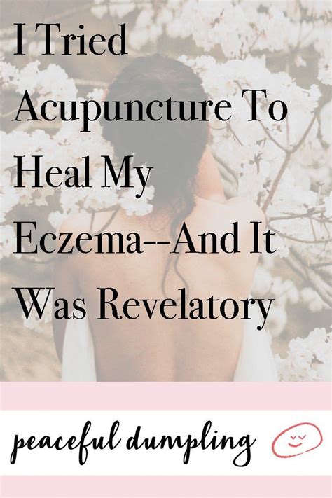 Acupuncture To Relief Pains Acupuncture Eczema Eczema Symptoms