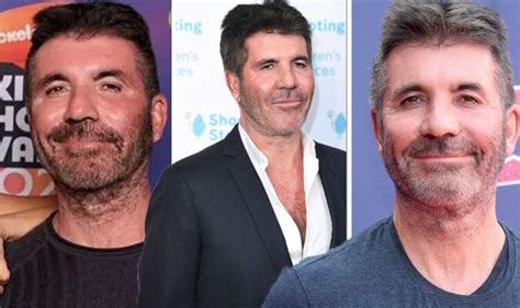 Simon Cowells Surgery To Achieve Ageless Face Hurt Like Hell Before