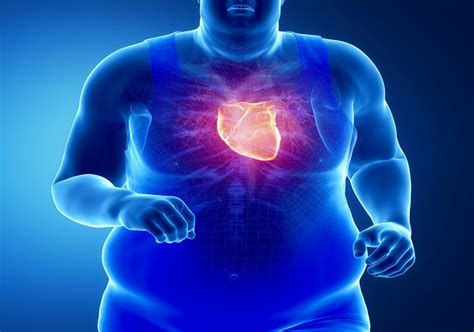 does obesity impact the heart 7medios