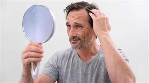 Recognise The Signs And What To Do In Case Of Crown Balding Onlymyhealth