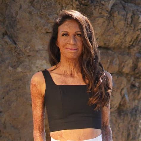 Overcoming Adversity Activating Your Full Potential With Turia Pitt