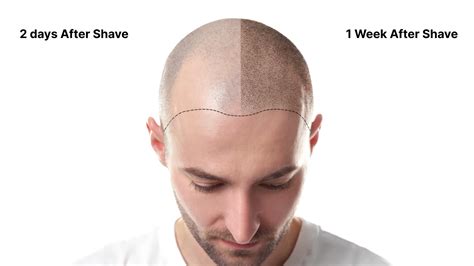 Should You Wash A Bald Head Every Day